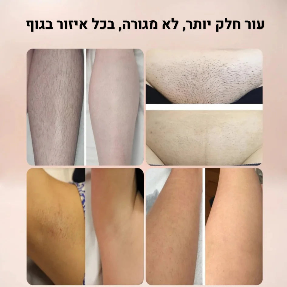 מכונת גילוח לנשים | בלום