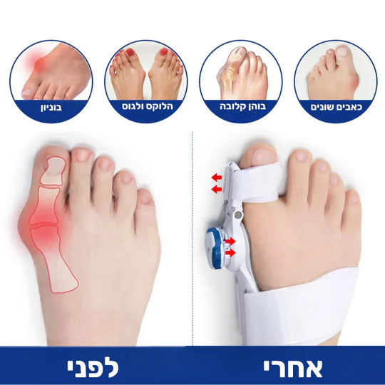 סטפ קאמפורתבלי רליף מקס - מכשיר הפחתת כאבי בוניונים אורטופדי