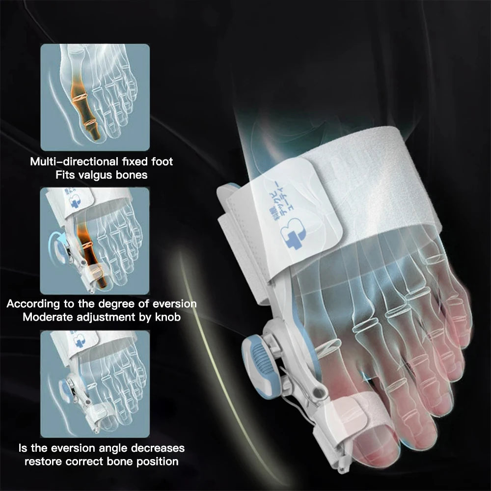 סטפ קאמפורתבלי רליף מקס - מכשיר הפחתת כאבי בוניונים אורטופדי